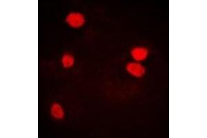 Immunofluorescent analysis of LSm4 staining in U2OS cells.