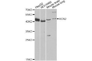Western blot analysis of extracts of various cell lines, using RCN2 antibody (ABIN6293762) at 1:1000 dilution. (RCN2 anticorps)