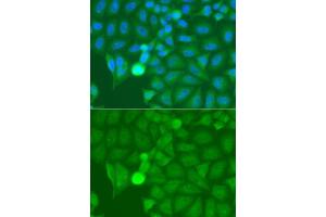 Immunofluorescence analysis of A549 cells using IRAK2 antibody.