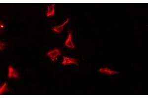 ABIN6275777 staining HeLa by IF/ICC. (IL-4 anticorps  (Internal Region))