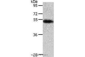 Western blot analysis of Human liver cancer tissue, using AGT Polyclonal Antibody at dilution of 1:700 (AGT anticorps)