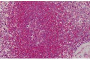 Human Spleen: Formalin-Fixed, Paraffin-Embedded (FFPE) (TM7 anticorps)