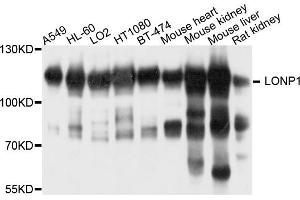 Western blot analysis of extracts of various cell lines, using LONP1 antibody. (LONP1 anticorps)