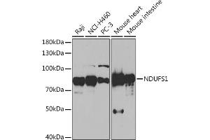 Western blot analysis of extracts of various cell lines, using NDUFS1 Rabbit pAb (ABIN7268819) at 1:1000 dilution. (NDUFS1 anticorps  (AA 80-290))