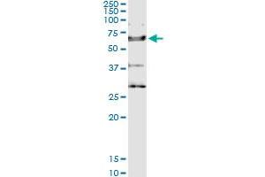 anti-Interleukin 18 Receptor 1 (IL18R1) (AA 1-541) antibody