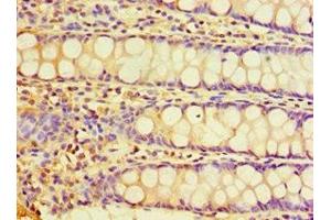Immunohistochemistry of paraffin-embedded human colon tissue using ABIN7147675 at dilution of 1:100 (CHRFAM7A anticorps  (AA 1-150))