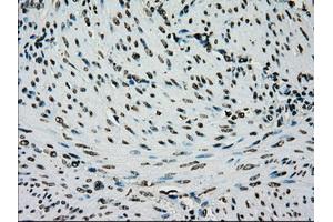 Image no. 1 for anti-Premelanosome Protein (PMEL) antibody (ABIN1500300)