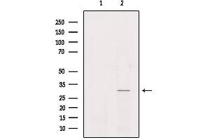 Western blot analysis of extracts from Hela, using NKX62 Antibody. (NKX6-2 anticorps)