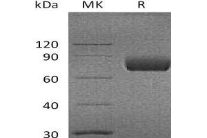 Western Blotting (WB) image for CD80 (CD80) protein (Fc Tag) (ABIN7320950) (CD80 Protein (CD80) (Fc Tag))