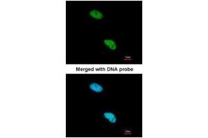 ICC/IF Image Immunofluorescence analysis of paraformaldehyde-fixed HeLa, using CBP80 , antibody at 1:200 dilution.
