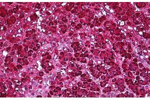 Human Adrenal: Formalin-Fixed, Parraffin-Embedded (FFPE) (Ferredoxin Reductase anticorps)