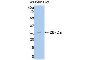 Detection of Recombinant TMEM173, Human using Polyclonal Antibody to Transmembrane Protein 173 (TMEM173)