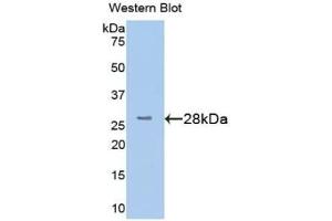 Detection of Recombinant TMEM173, Human using Polyclonal Antibody to Transmembrane Protein 173 (TMEM173) (STING/TMEM173 anticorps  (AA 159-373))