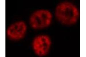 ABIN6277745 staining HeLa cells by IF/ICC. (MDM4-binding Protein anticorps  (Internal Region))