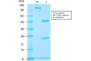 SDS-PAGE Analysis Purified AMACR Recombinant Mouse Monoclonal Antibody (rAMACR/1864).