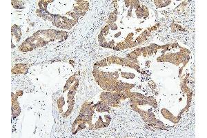IHC analysis of OLMF4 using anti-OLMF4 antibody (ABIN6719350). (Olfactomedin 4 anticorps  (AA 91-510))