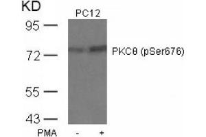 Image no. 4 for anti-Protein Kinase C, theta (PRKCQ) (pSer676) antibody (ABIN197071) (PKC theta anticorps  (pSer676))