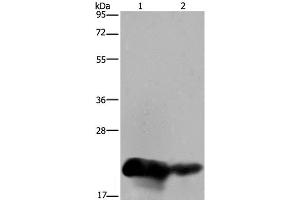 Western Blot analysis of Human placenta and breast infiltRative duct tissue using CSH1 Polyclonal Antibody at dilution of 1:200 (CSH1 anticorps)