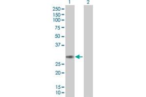Western Blot analysis of PCSK4 expression in transfected 293T cell line ( H00054760-T01 ) by PCSK4 MaxPab polyclonal antibody. (PCSK4 anticorps  (AA 1-242))