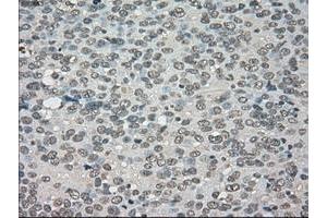 Image no. 3 for anti-Neurotrophic tyrosine Kinase, Receptor, Type 3 (NTRK3) antibody (ABIN1499842)