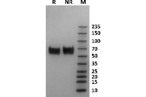 Human Fc gamma RI / CD64 protein on Coomassie Blue stained SDS-PAGE under non-reducing (NR) and reducing (R) conditions.