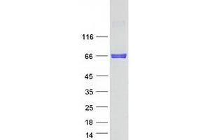 Validation with Western Blot