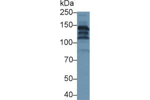 Detection of CP in Human Serum using Polyclonal Antibody to Ceruloplasmin (CP)