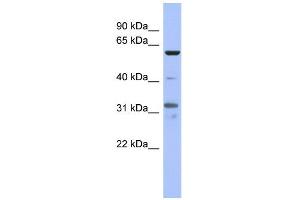 WB Suggested Anti-PAX8 Antibody Titration:  0. (PAX8 anticorps  (Middle Region))