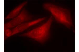 Immunofluorescence staining of methanol-fixed HeLa cells using G3BP1 (phospho S232) polyclonal antibody . (G3BP1 anticorps  (pSer232))