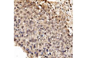 IHC analysis of IFI16 using anti-IFI16 antibody (ABIN7600374). (IFI16 anticorps  (AA 183-743))