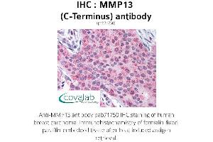 Image no. 1 for anti-Matrix Metallopeptidase 13 (Collagenase 3) (MMP13) (C-Term) antibody (ABIN1737010) (MMP13 anticorps  (C-Term))