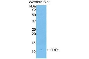 Western Blotting (WB) image for anti-CD3d Molecule, delta (CD3-TCR Complex) (CD3D) (AA 22-106) antibody (ABIN3205925) (CD3D anticorps  (AA 22-106))