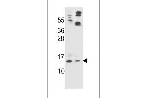Western blot analysis in HL-60(lane 1),A549(lane 2) cell line lysates (35ug/lane). (Apolipoprotein C-II anticorps  (AA 45-73))