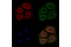 ABIN6263885 and ABIN6272707 staining Hela cells by IF/ICC.