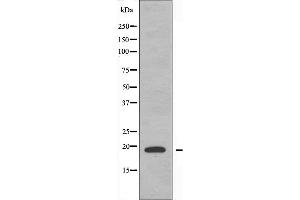 Western blot analysis of extracts from RAW264. (PTTG1IP anticorps  (C-Term))