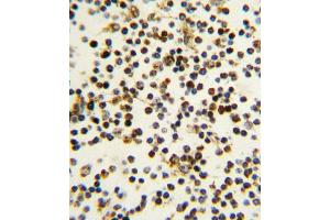 Formalin-fixed and paraffin-embedded human lymph tissue reacted with N antibody (N-term) (ABIN389342 and ABIN2839451) , which was peroxidase-conjugated to the secondary antibody, followed by DAB staining.