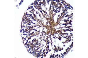 Immunohistochemistry of paraffin-embedded Rat testis using Bif-1 Rabbit pAb (ABIN7270280) at dilution of 1:100 (40x lens).