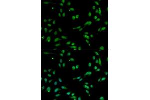 Immunofluorescence analysis of A549 cells using ANP32A antibody.