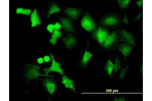 Immunofluorescence of monoclonal antibody to PPM1B on HeLa cell.
