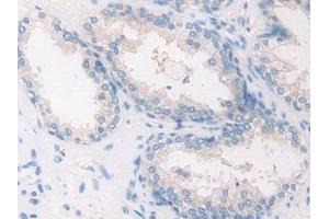 Detection of CaN in Human Prostate Tissue using Polyclonal Antibody to Calcineurin (CaN)