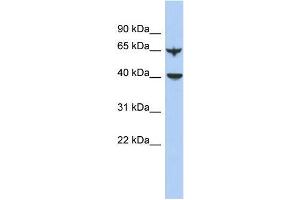 Human Lung; WB Suggested Anti-APOBEC4 Antibody Titration: 0. (APOBEC4 anticorps  (N-Term))