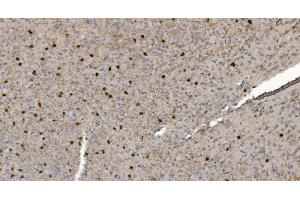 IHC analysis of Alpha B Crystallin/CRYAB using anti-Alpha B Crystallin/CRYAB antibody (ABIN7601209). (CRYAB anticorps  (AA 30-151))