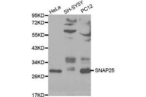 Western blot analysis of extracts of various cell lines, using SNAP25 antibody (ABIN5970374) at 1/1000 dilution. (SNAP25 anticorps)