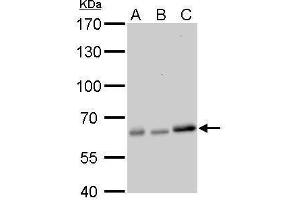 WB Image AMPK alpha 2 antibody detects PRKAA2 protein by Western blot analysis. (PRKAA2 anticorps  (Center))
