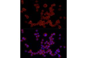 Immunofluorescence analysis of R.
