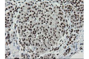 Image no. 5 for anti-Transducin-Like Enhancer of Split 1 (E(sp1) Homolog, Drosophila) (TLE1) (AA 180-460) antibody (ABIN1491049)