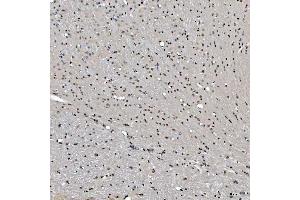 IHC analysis of SNRNP27 using anti-SNRNP27 antibody (ABIN7599614). (SNRNP27 anticorps  (AA 100-155))