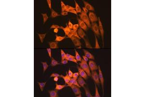 Immunofluorescence analysis of NIH-3T3 cells using Calpain 1 Rabbit mAb (ABIN7266033) at dilution of 1:100 (40x lens).