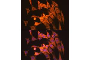 Immunofluorescence analysis of NIH-3T3 cells using Calpain 1 Rabbit mAb (ABIN7266033) at dilution of 1:100 (40x lens). (CAPNL1 anticorps)
