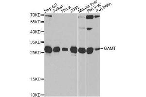 Western blot analysis of extracts of various cell lines, using GAMT antibody. (GAMT anticorps  (AA 1-236))